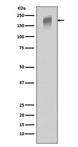 VEGF Receptor 1 Ab