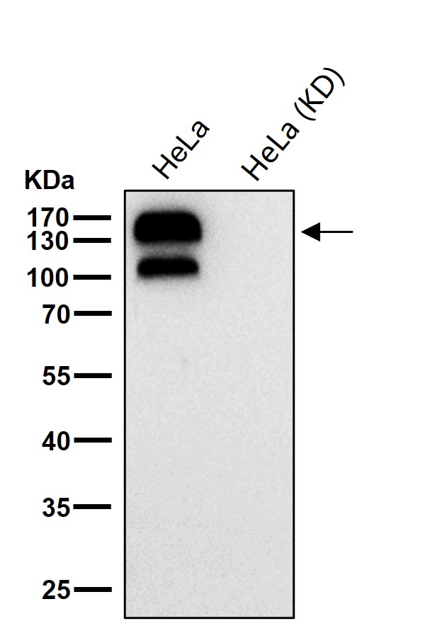 Integrin beta 1 Ab