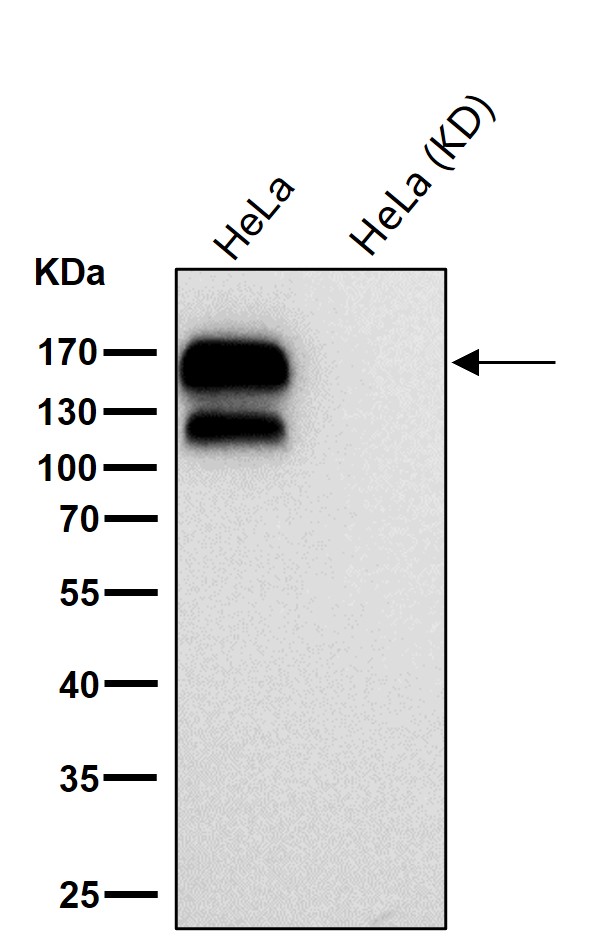 Integrin beta 1 Ab