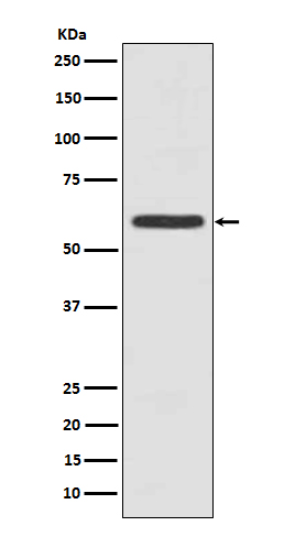 Cytokeratin 5 Ab