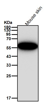 Cytokeratin 5 Ab