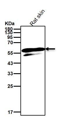 Cytokeratin 5 Ab