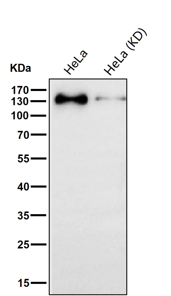 TACC3 Ab