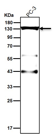 TACC3 Ab