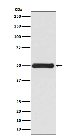 Vimentin Ab