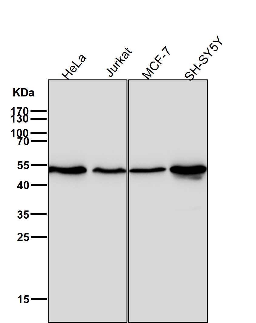 Vimentin Ab