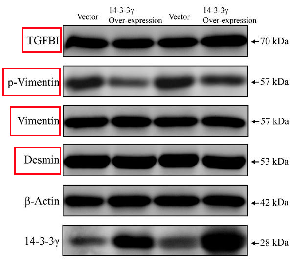 Vimentin Ab