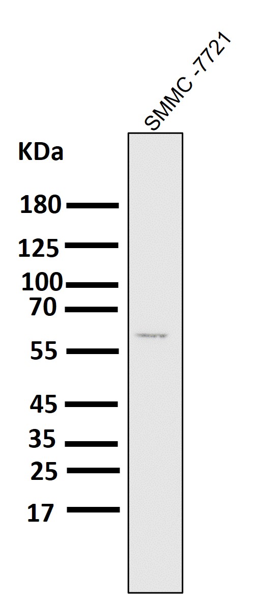 Vimentin Ab