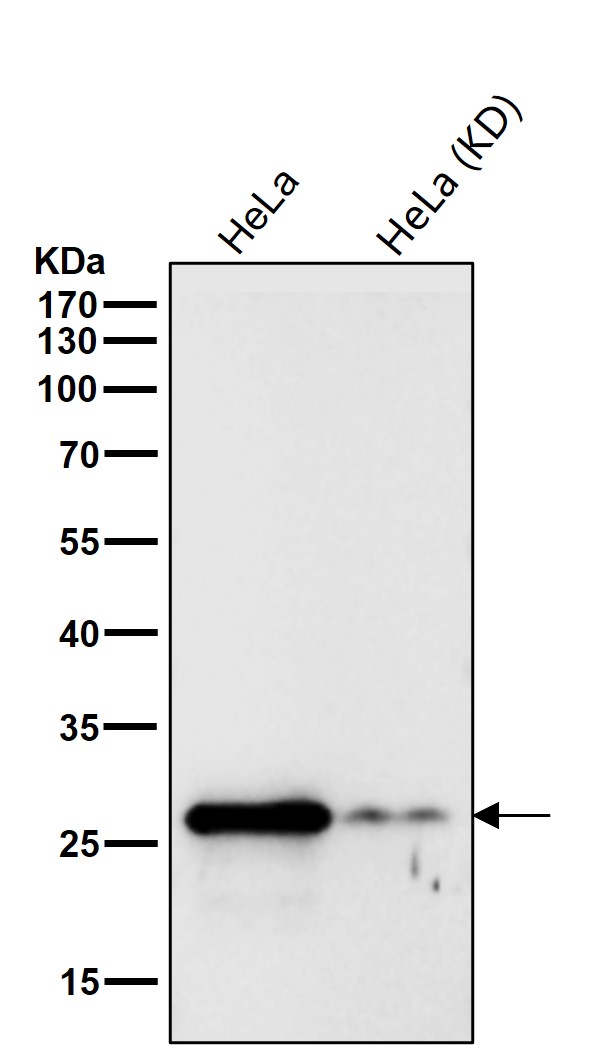 Galectin 3 Ab