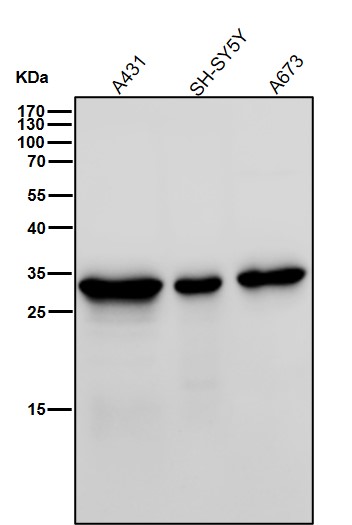 Galectin 3 Ab