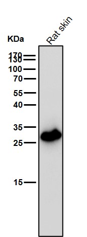 Galectin 3 Ab