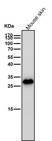 Galectin 3 Ab