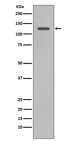 INPP5D Ab