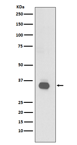 CD20 Ab