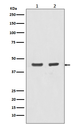 alpha Skeletal muscle actin Ab