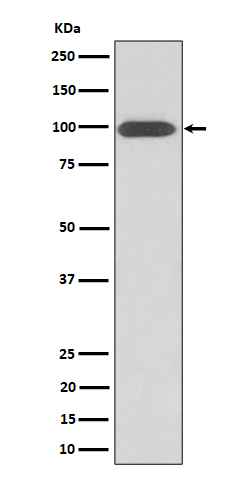 Integrin beta 3 Ab