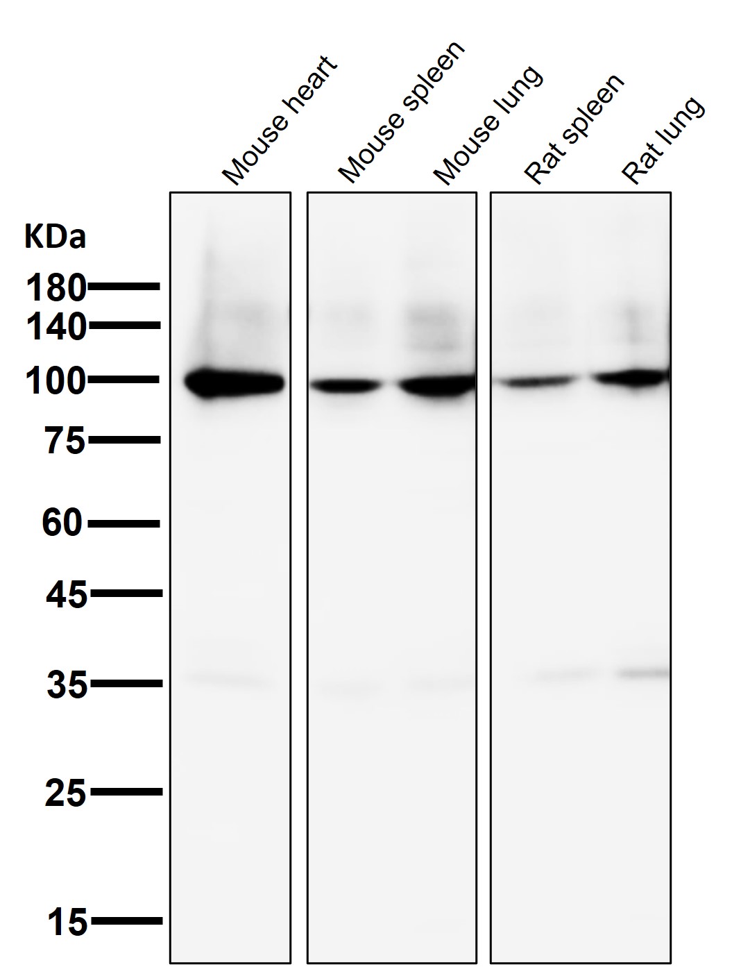 Sodium potassium ATPase Ab