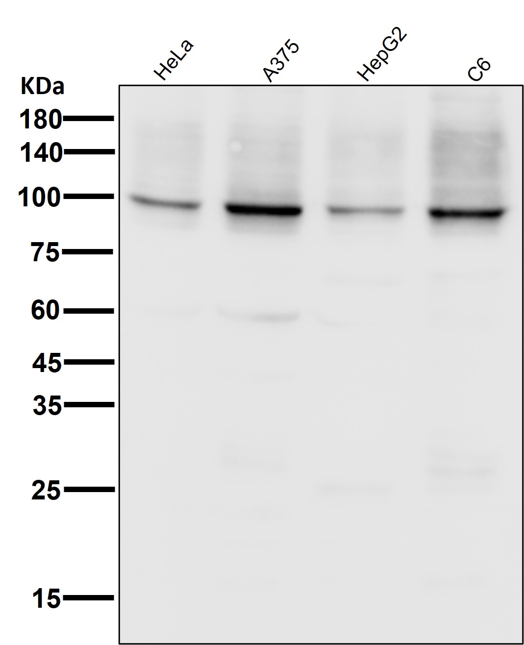 Sodium potassium ATPase Ab