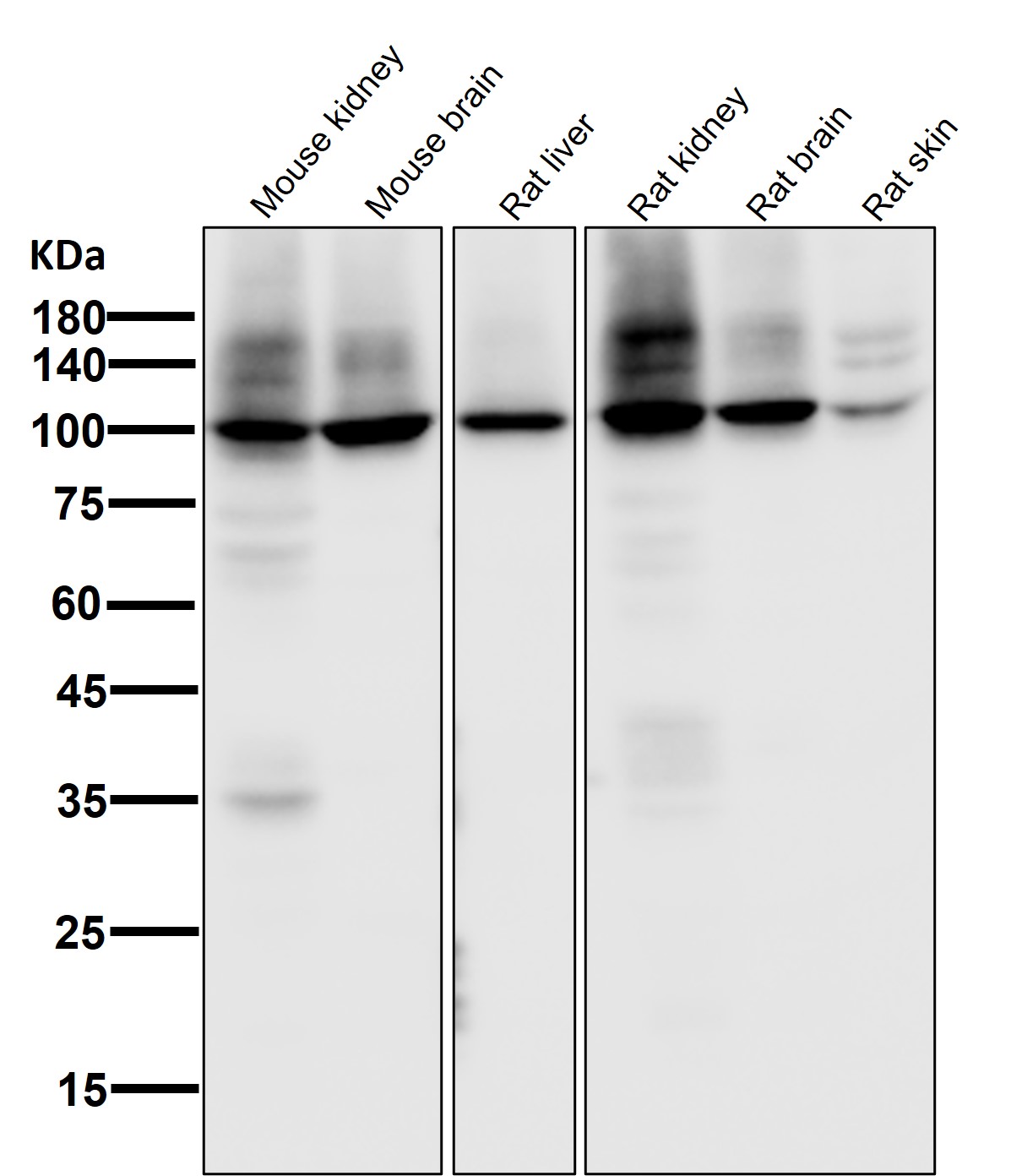 Sodium potassium ATPase Ab