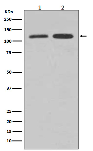 Vinculin Ab