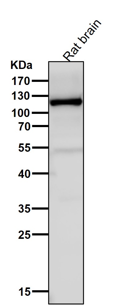 Vinculin Ab