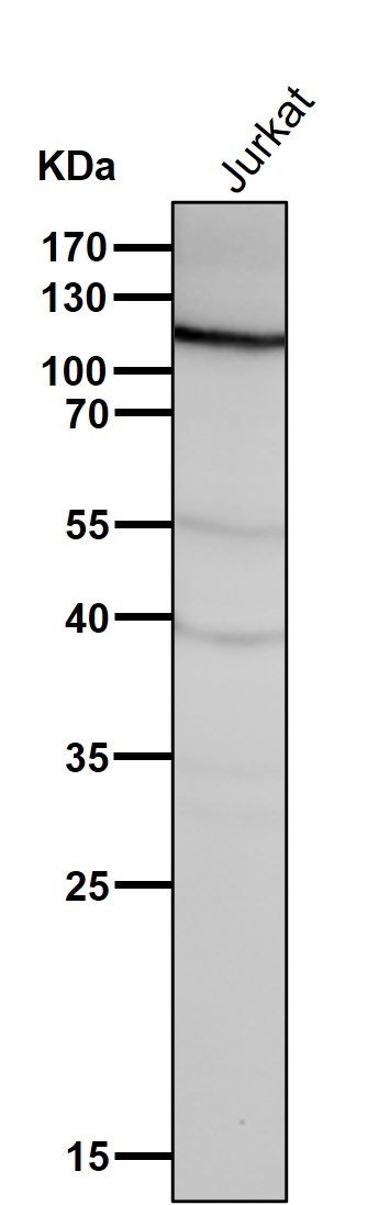 Vinculin Ab