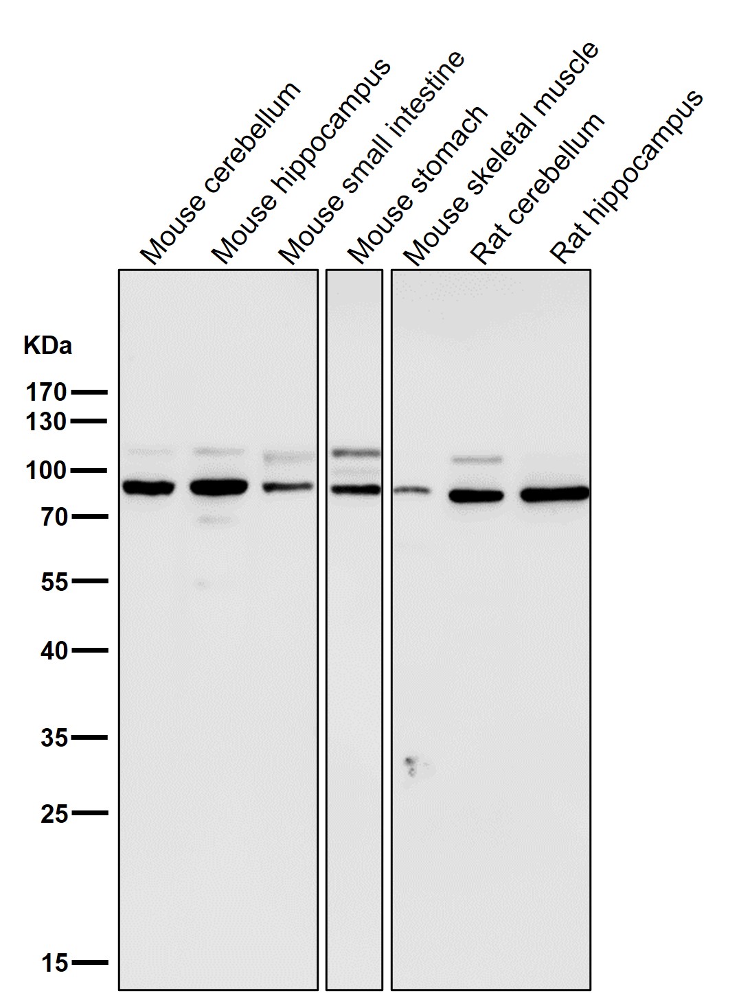 STAT3 Ab