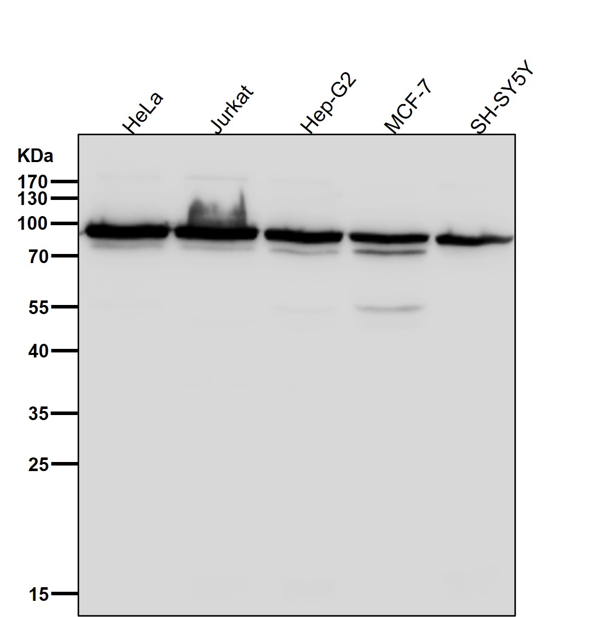 Hsp90 beta Ab