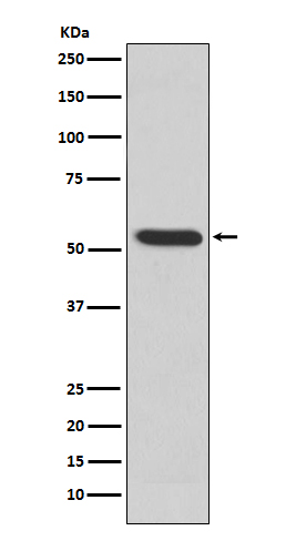 MMP3 Ab