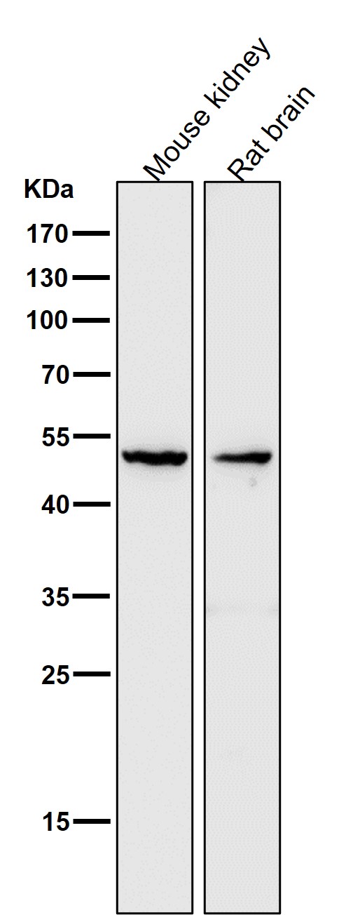 MMP3 Ab