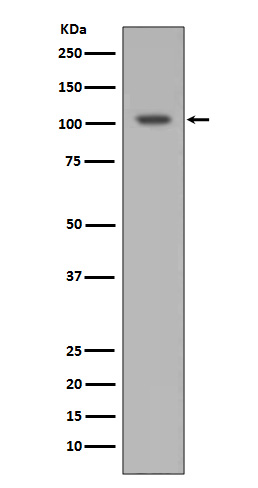 HIF 1 alpha Ab