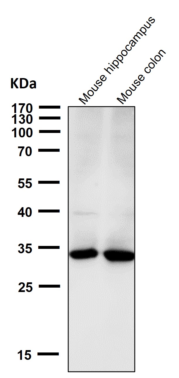 Calponin 1 Ab