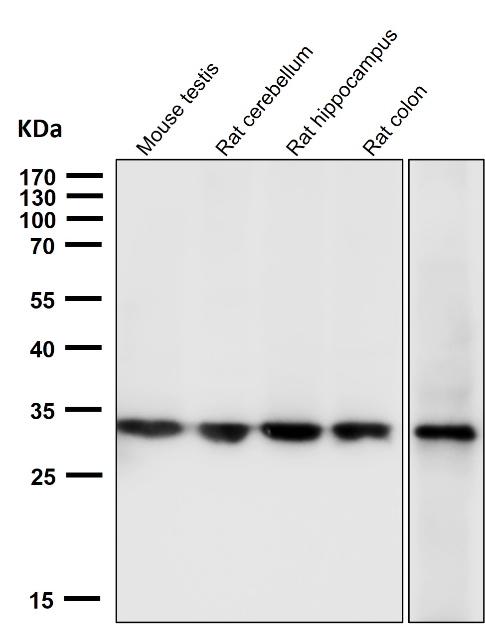 Calponin 1 Ab