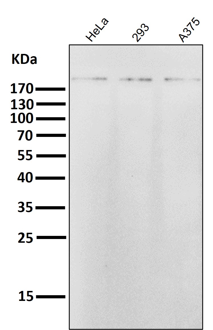 ErbB2 Ab