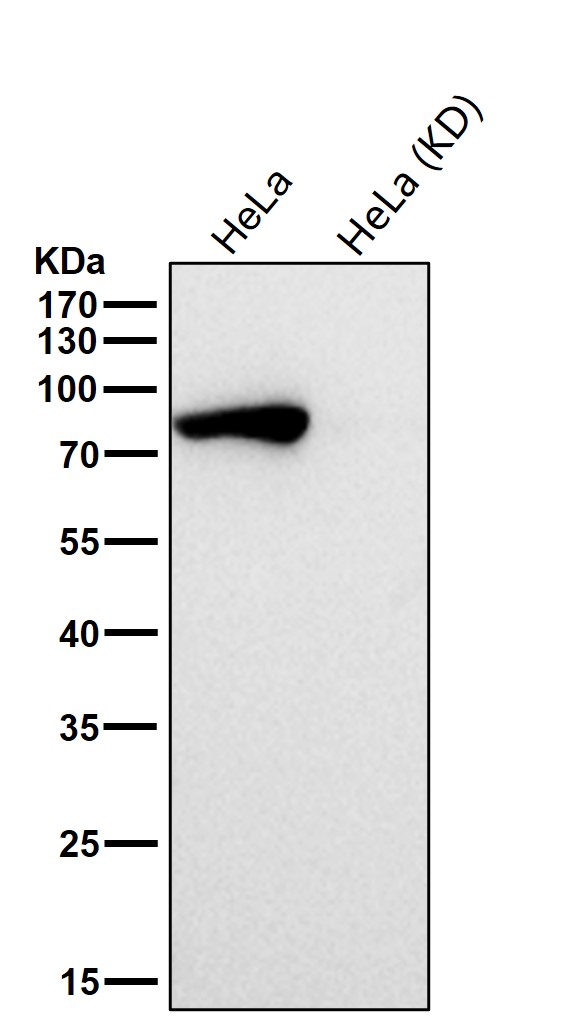 STAT1 Ab