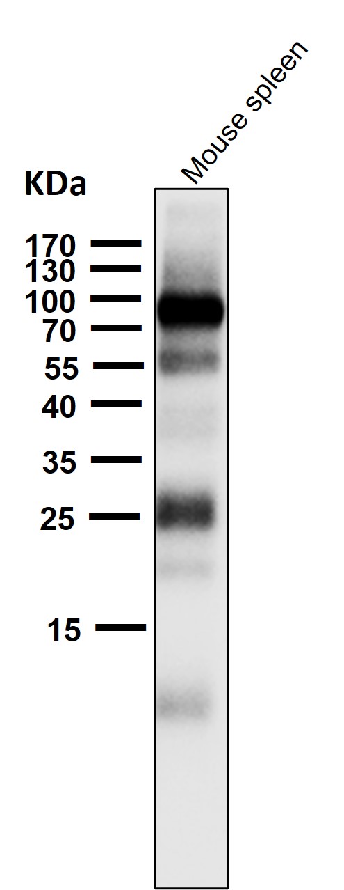 STAT1 Ab