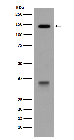 LDL receptor Ab