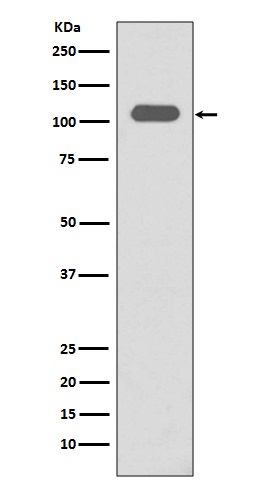 Integrin beta 3 Ab