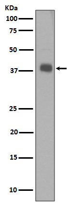 Synaptophysin Ab