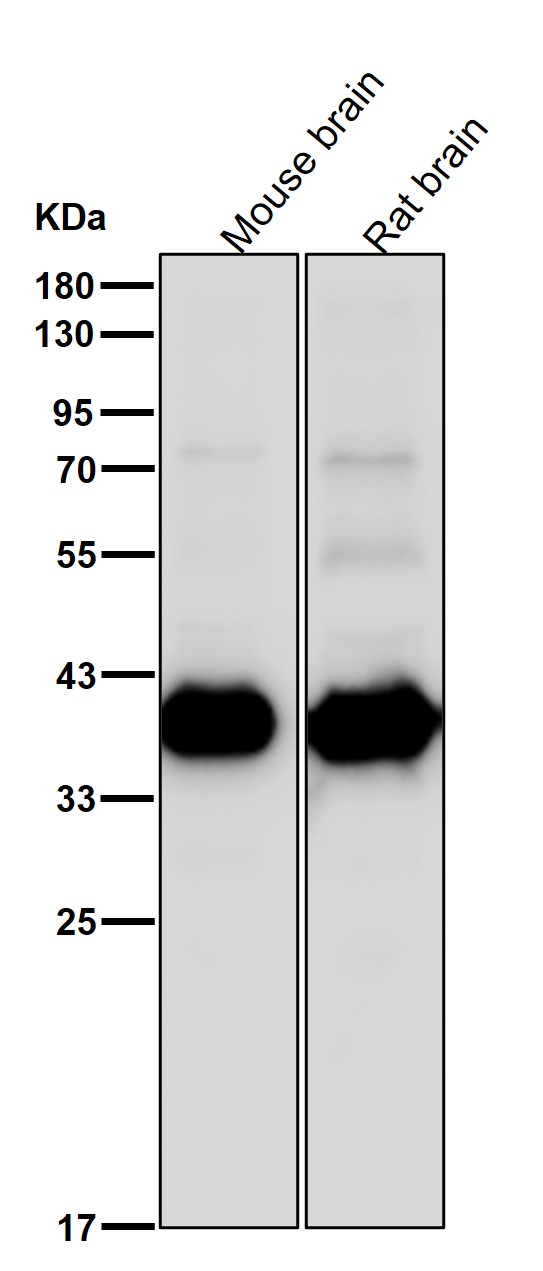 Synaptophysin Ab