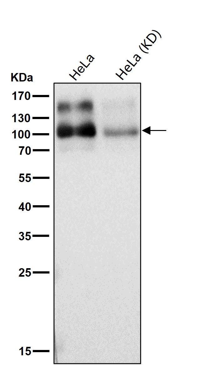 Amyloid beta A4 Ab