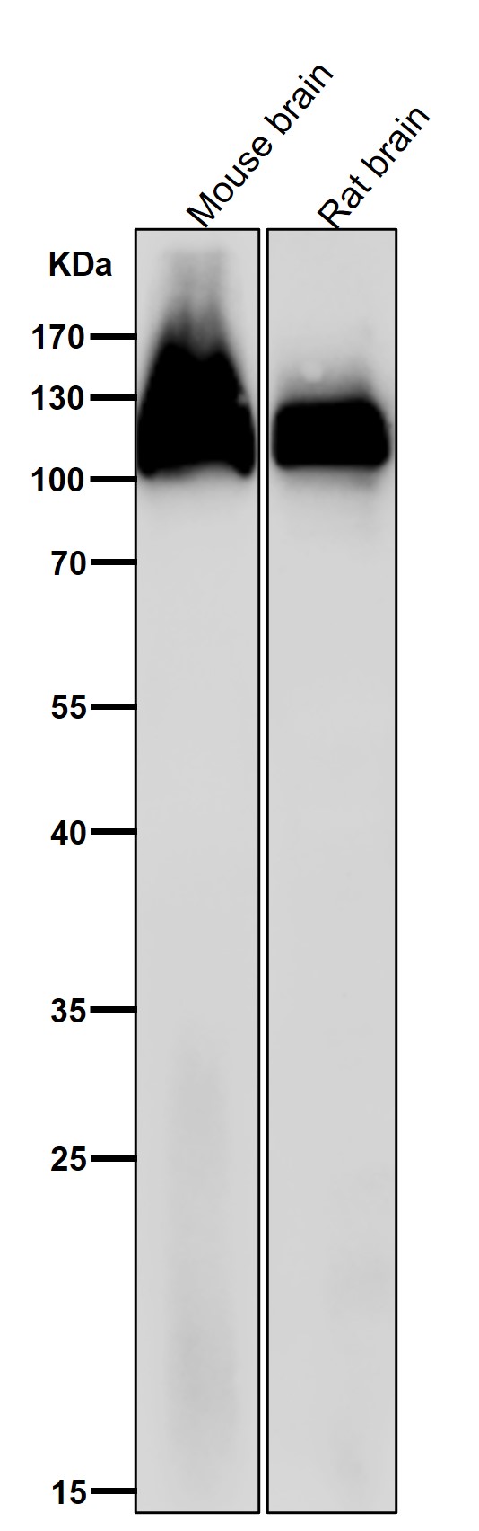 Amyloid beta A4 Ab