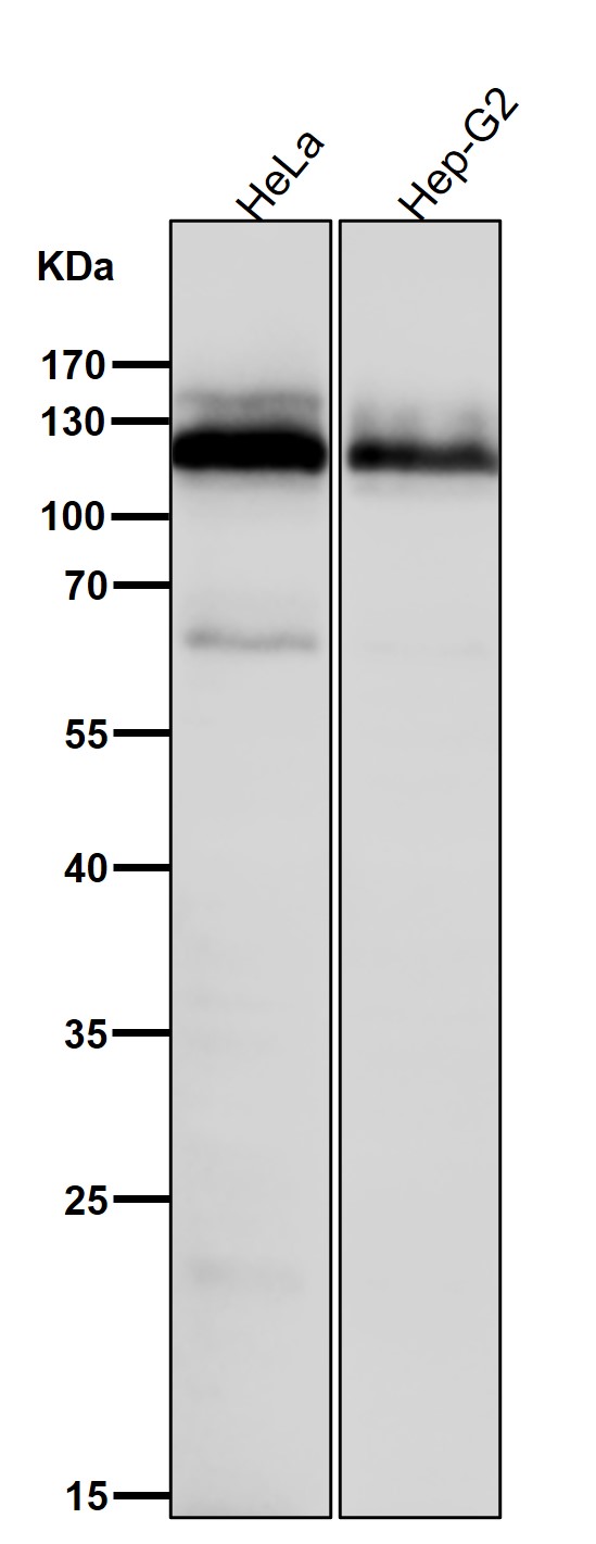 Amyloid beta A4 Ab