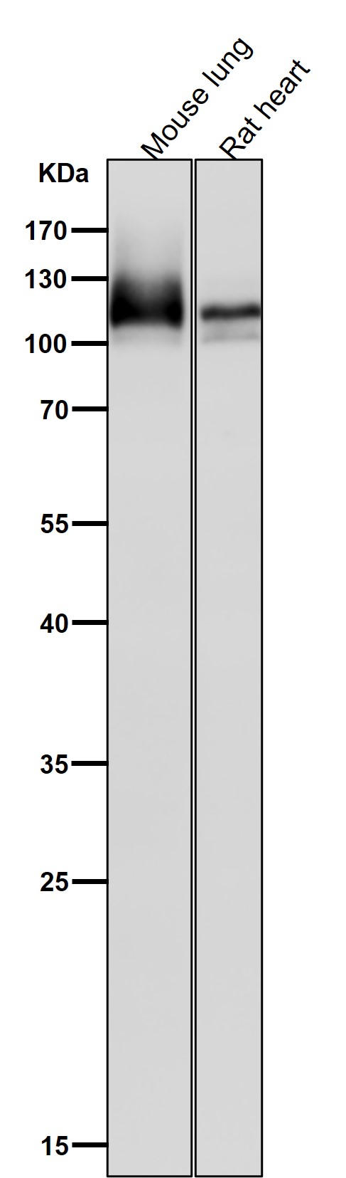 Amyloid beta A4 Ab