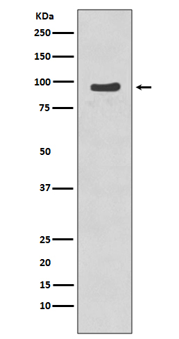 p-p95 NBS1 (S343) Ab