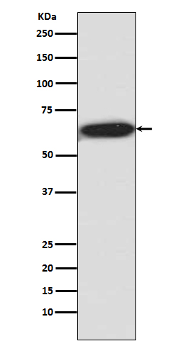 p-p70 S6 Kinase (T421/S424) Ab