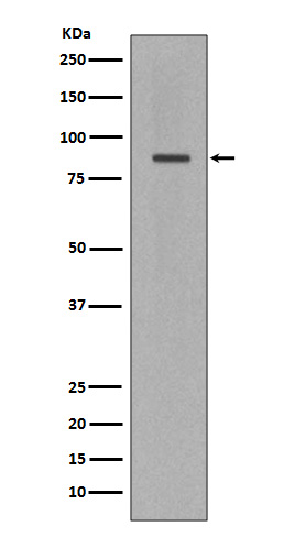 Cleaved-PARP 1 (D214) Ab