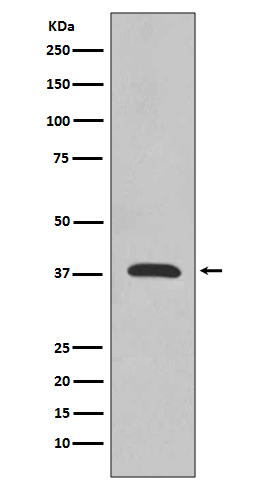 Synaptophysin Ab