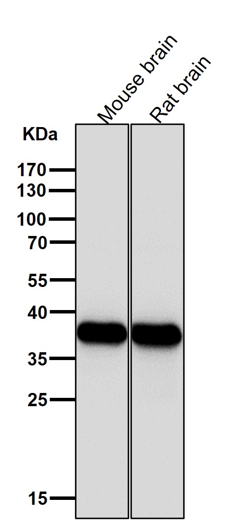 Synaptophysin Ab