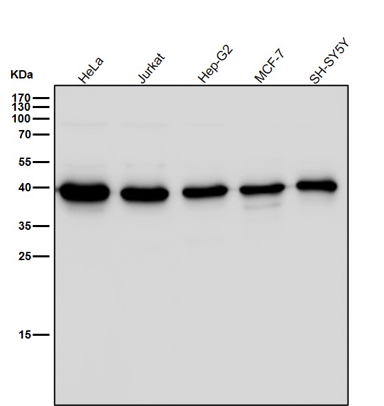 Nkx 2.1 Ab